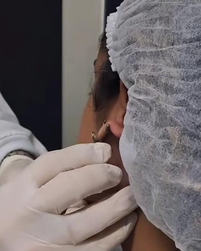 Detalhe de treinamento de coleta